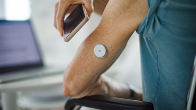 The Role of Continuous Glucose Monitoring (CGM) Systems in Diabetes Management